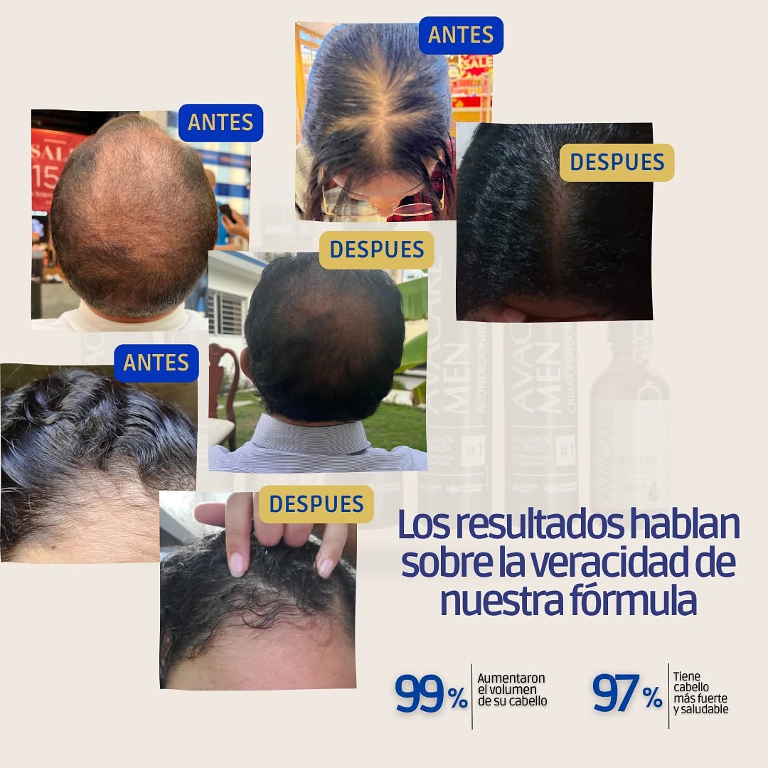 KIT AVAWOMEN THERAPY 32 ONZA